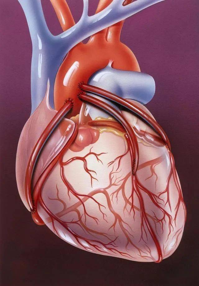 冠脉粥样硬化冠心病心绞痛心肌梗死怎么治疗