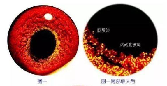 眼镜瞳孔会放大放小_放大瞳孔的眼药水危害_瞳孔放大是什么意思