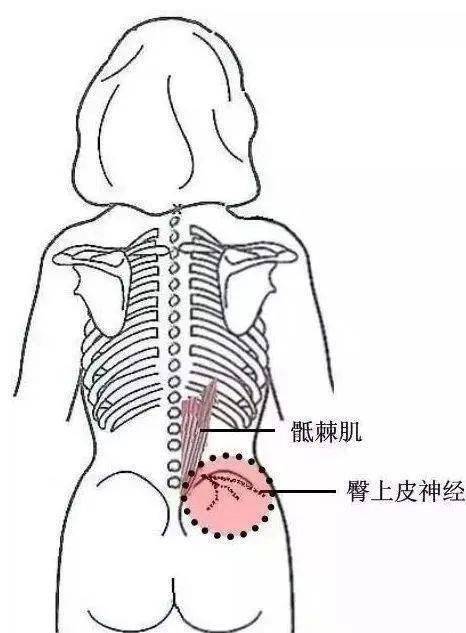 【干货】臀—4个方位·腿—5个方位的疼痛意义(上篇)