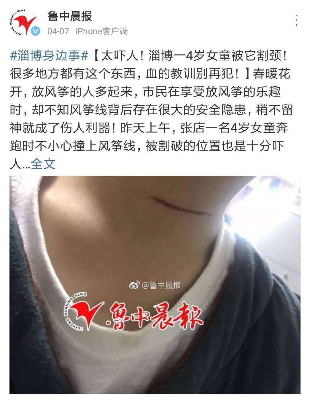 4岁女童被它瞬间割颈!现在这东西很多,血的教训别再犯!