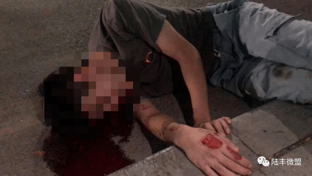 凌晨,在40米大道金丽华附近发生一宗车祸,一男子倒地,头部受伤流血!