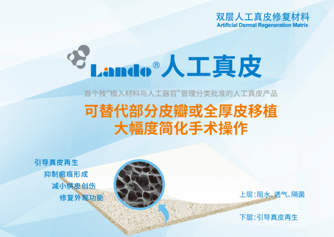 人工真皮产品,可替代部分皮瓣或全厚皮移植,大幅度简化手术操作兰度