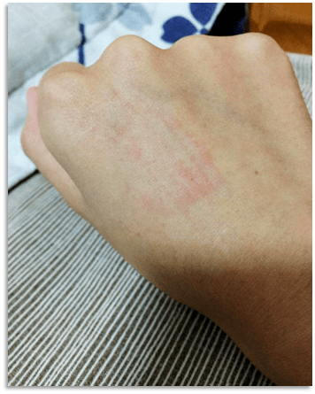 动物舔触处的皮肤有破损;动物舔触处的粘膜被唾液污染;与蝙蝠有接触