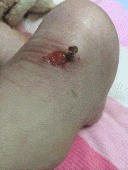 一个logo并不会换来真心的尊重,反而双脚被磨得红肿,起泡,甚至鲜血