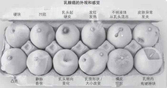 橘皮样乳房图片图片