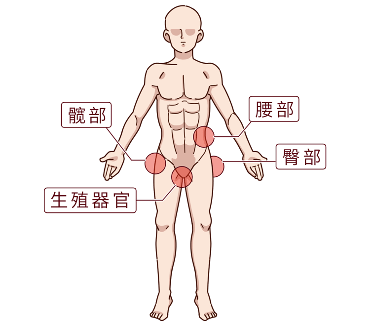 前列腺炎腰痛的位置图图片