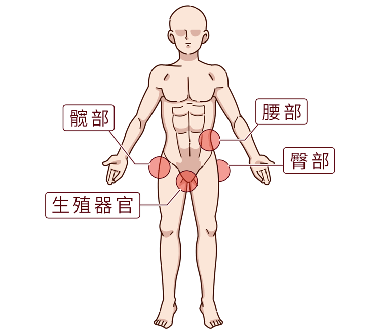 或  生殖器官疼痛