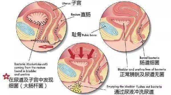 子宫膀胱尿道位置图片图片