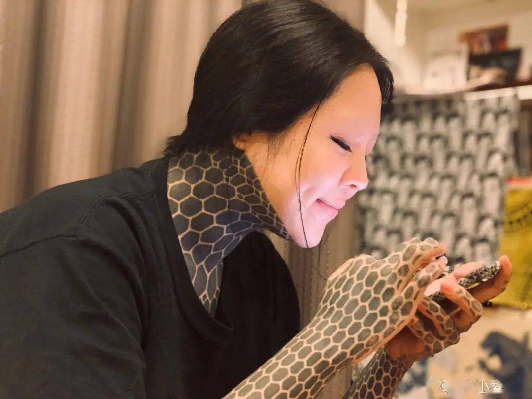 割皮纹身师小爱告诉我女孩们用剥离皮肤的方式掩盖过去的伤痕