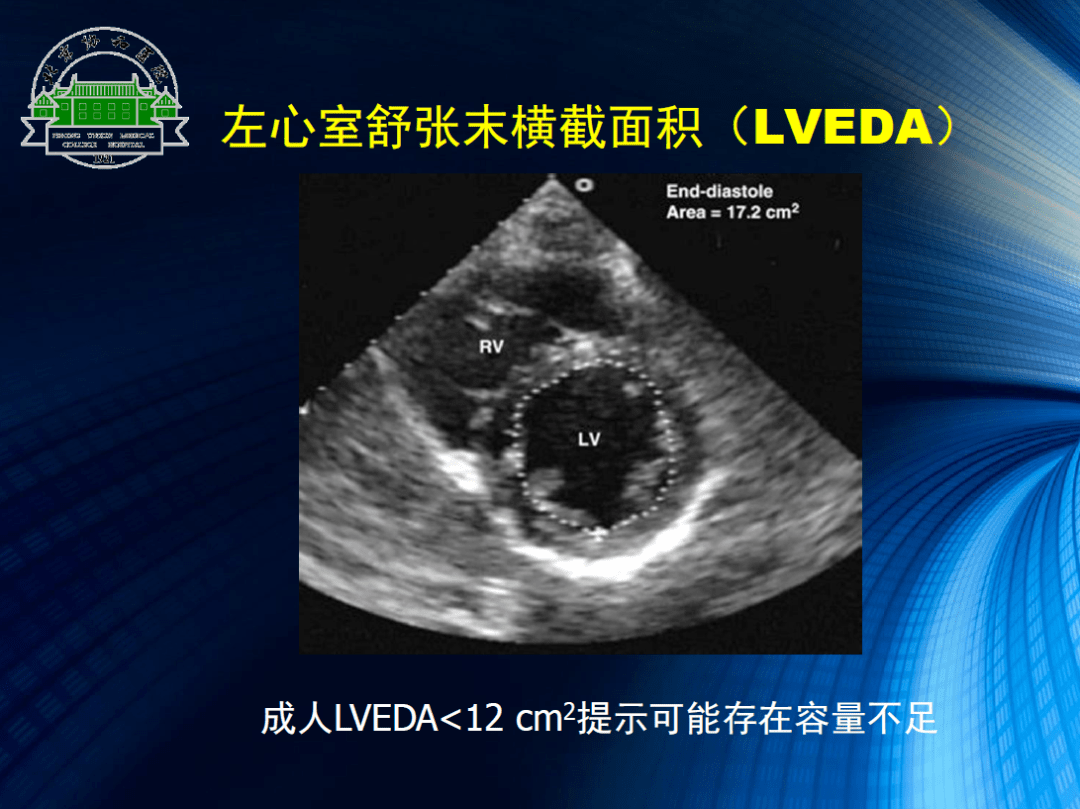 讲师简介|宋锴澄北京协和医院麻醉科主任助理,心血管麻醉亚专业组组长