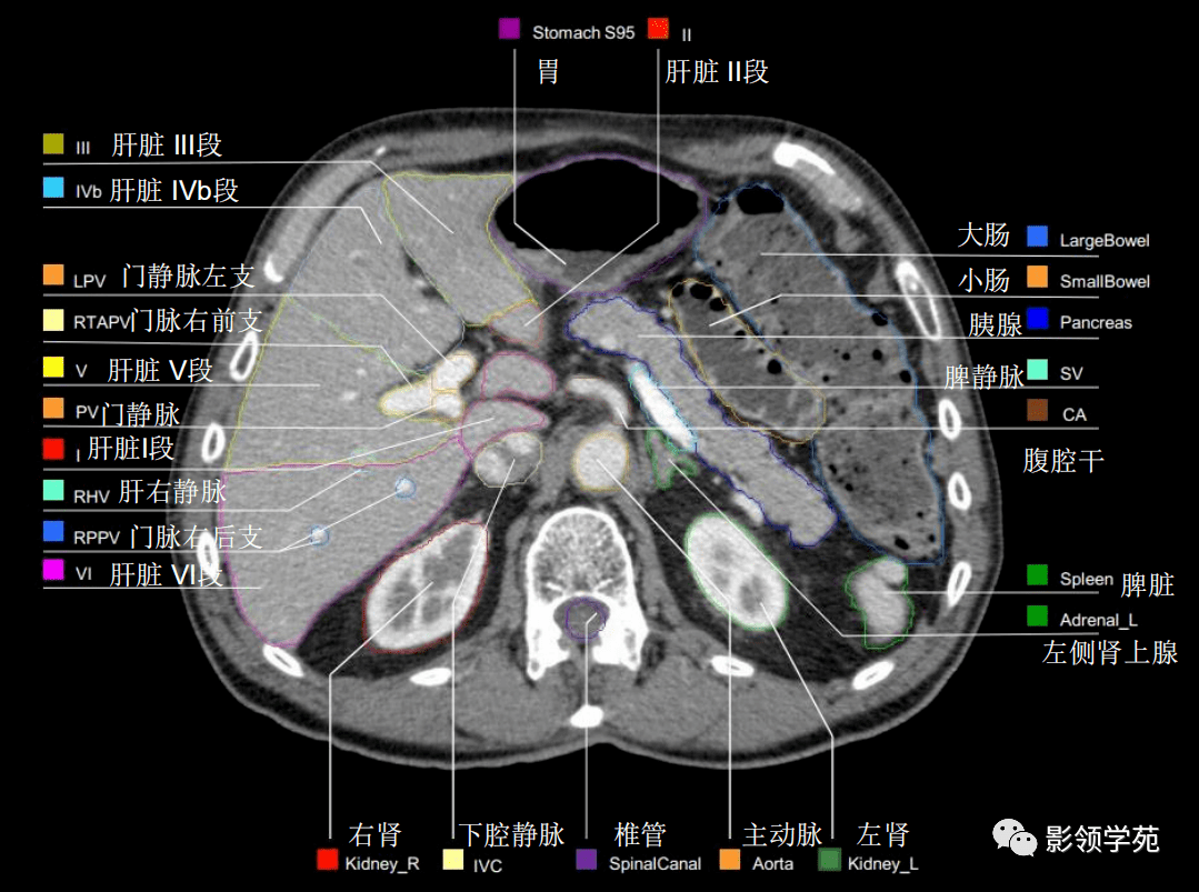 腹部影像学解剖图谱,拿走不谢!