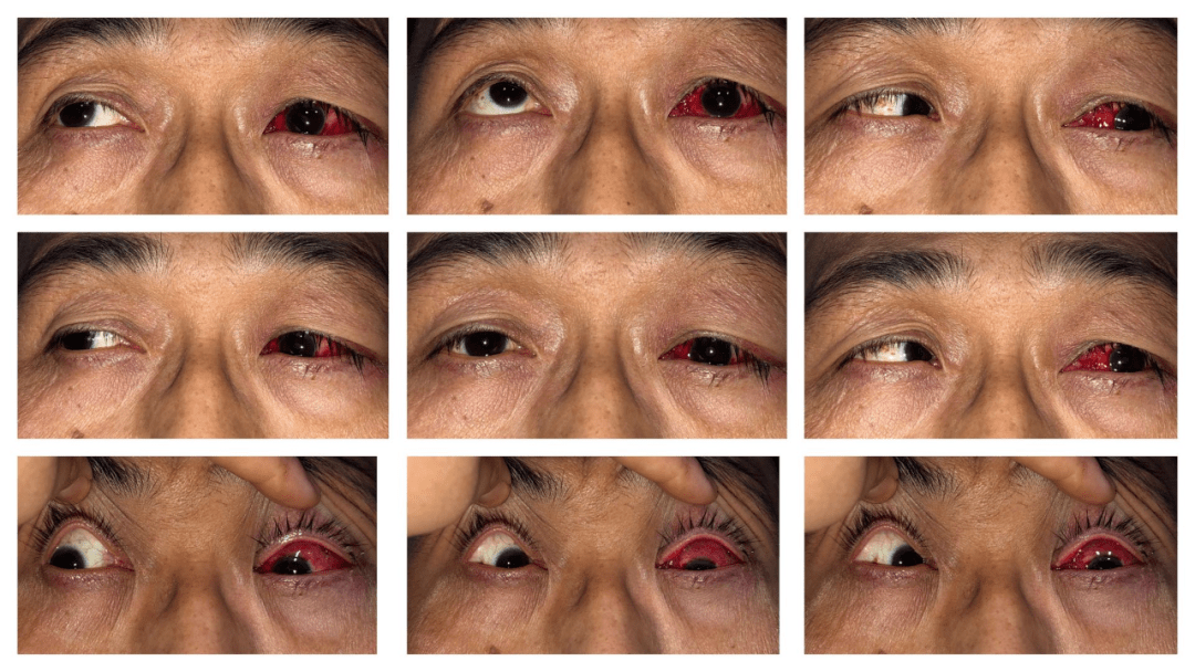 【医疗动态】小儿眼科的大朋友