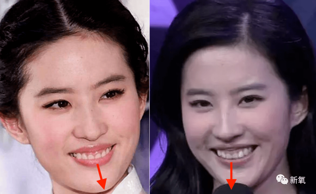 刘亦菲和刘诗诗都碰上水逆了吧,全网黑图删都删不完