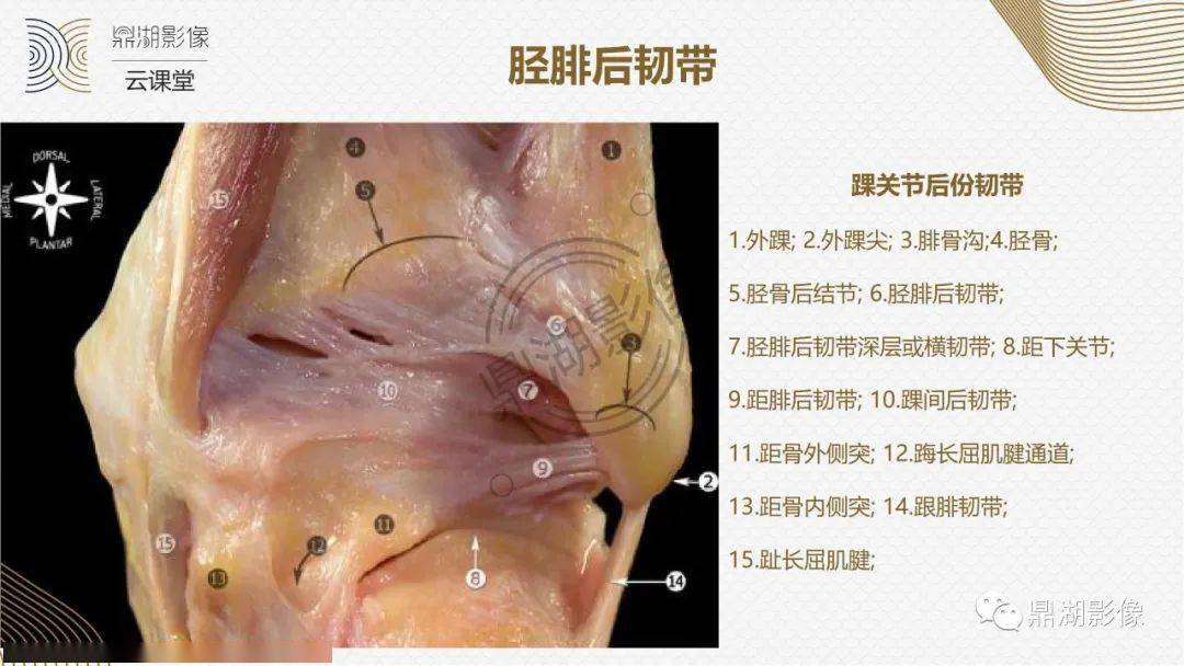 超讚這個踝關節mri解剖課件要給滿分