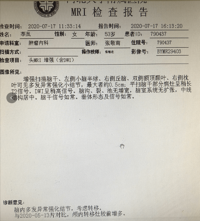 论坛mdt讨论李岚家病例分享