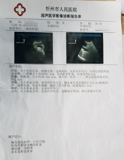 腹部彩超示胰头处低回声,有胰腺占位可能,且肝内外胆管及胰管扩张.