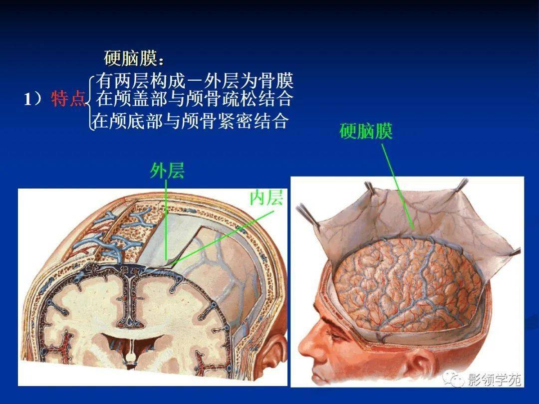 脑膜病变影像学诊断