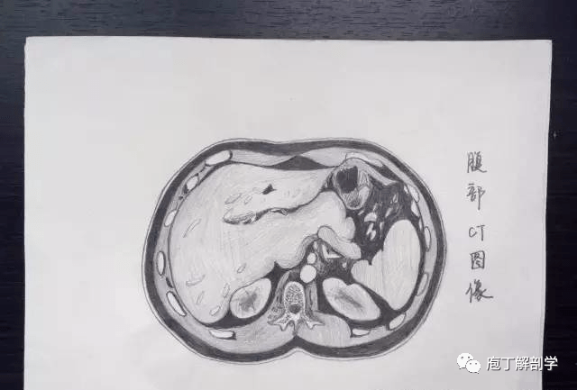 一看到這些醫生手繪的解剖圖我就震驚了