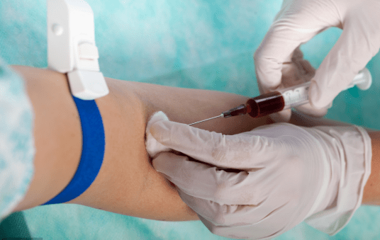 不空腹抽血能不能行?