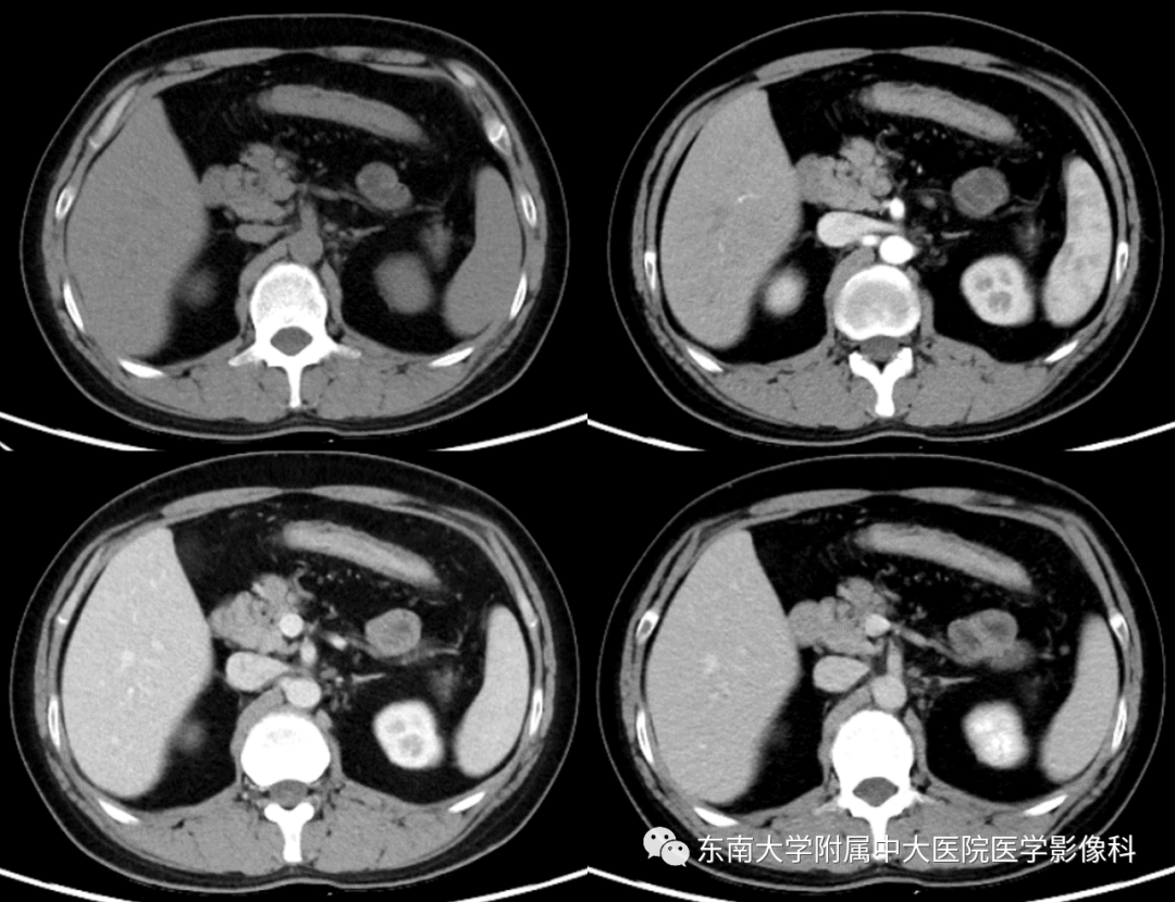 10 消化系统疾病——溃疡性结肠炎_手机搜狐网