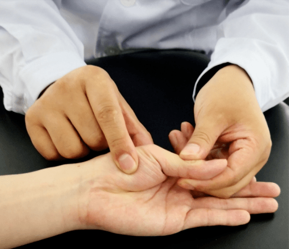 正中神经卡压与解剖学分析