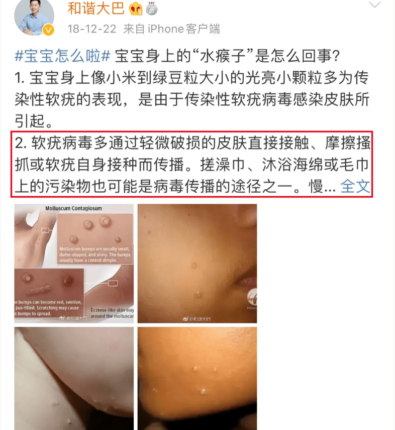 北京知名医生:冬天不要这样洗澡,麻烦太多,这个提醒太及时了~_皮肤