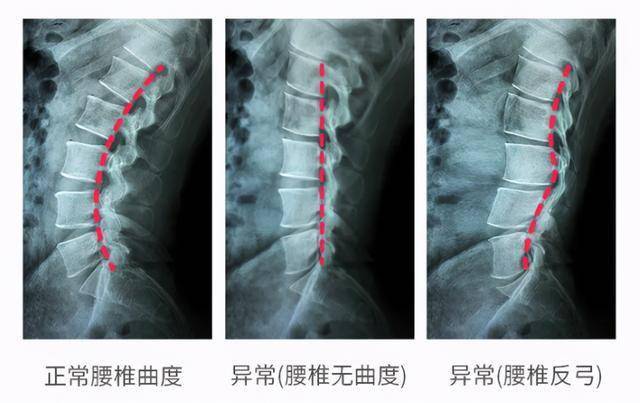 躺下就能感受泰式马杀鸡21位冠军运动员同款躺一下即刻放松