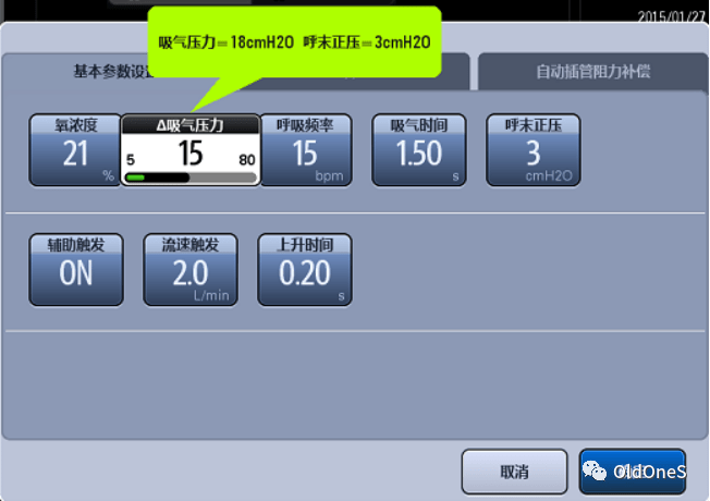 呼吸機常見通氣模式及參數調節