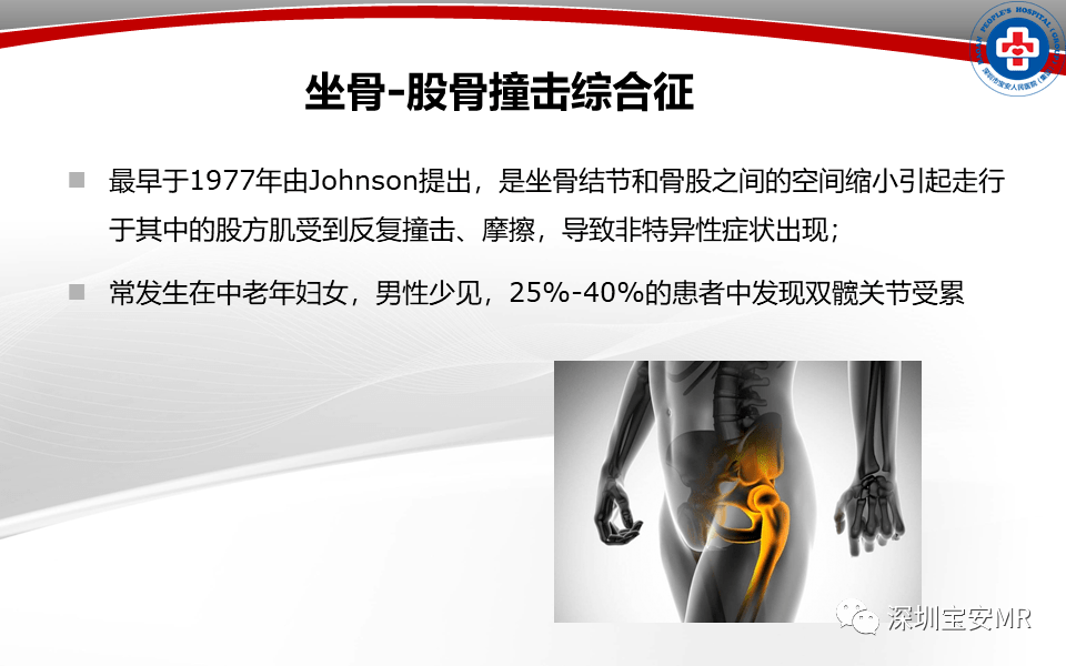 撞击综合征 来自搜狐网
