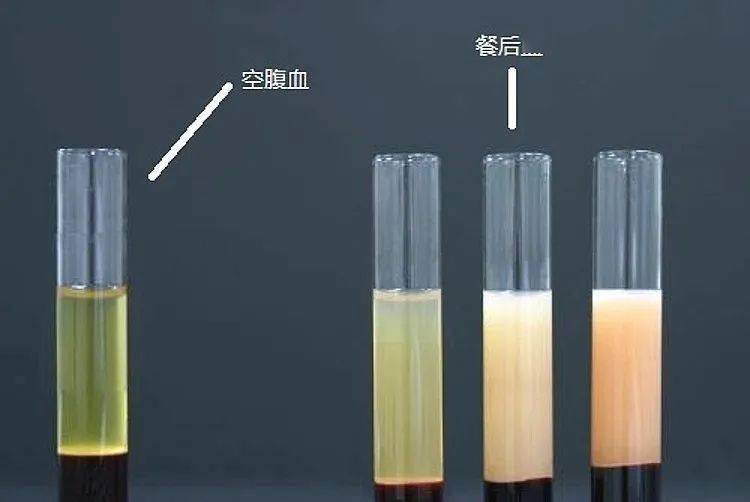 健康提醒空腹體檢需要禁食禁水怎樣才算空腹