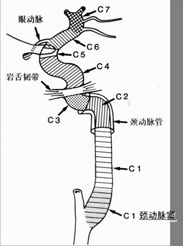 颈动脉分段示意图图片