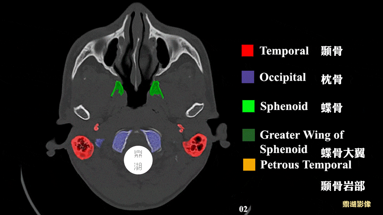 颅底骨断层解剖图片