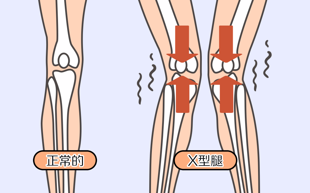 膝蓋疼是怎麼回事?這些原因不容忽視