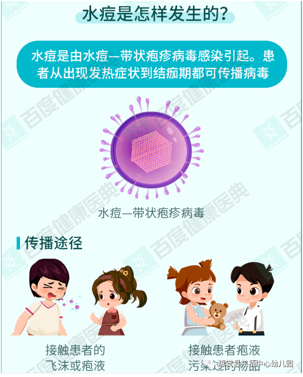 卫生保健惠安县东桥中心幼儿园预防水痘健康知识宣传