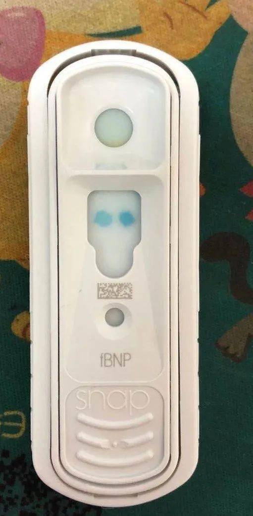 肥厚性心肌病养猫人必须知道的一种疾病