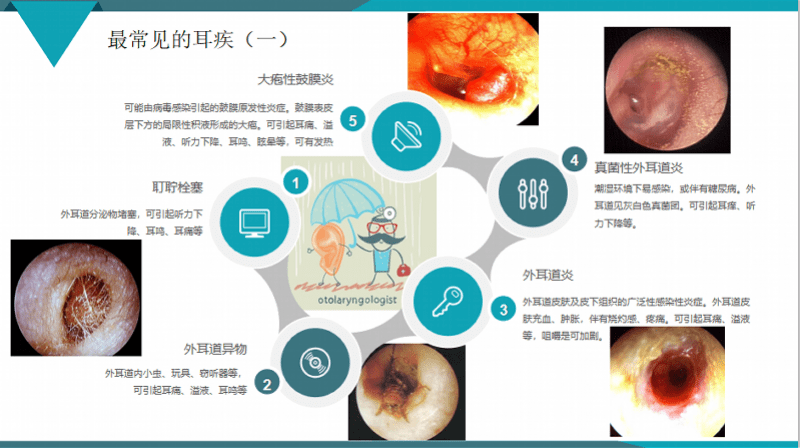 导致耳膜穿孔的坏习惯有人天天做专家提醒耳朵不能乱掏