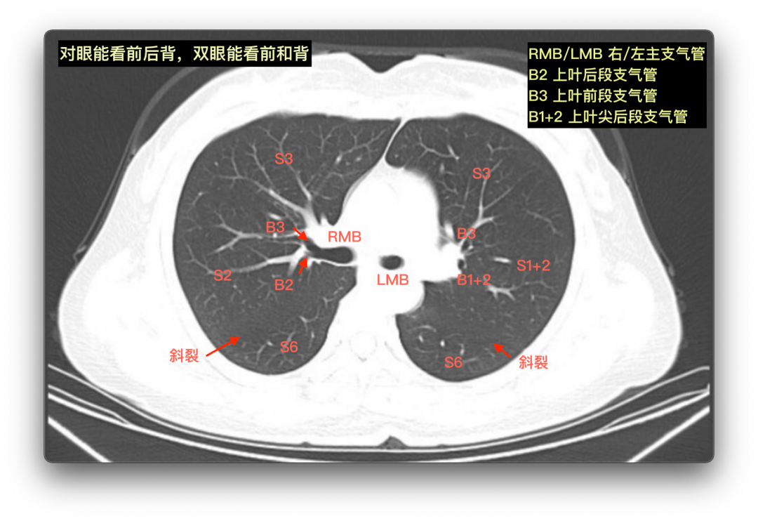 叶后段支气管的层面1首先,我们来看一位患者高分辨胸ct的肺窗连续断面