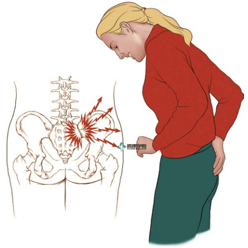 疼痛解剖学骶髂关节痛