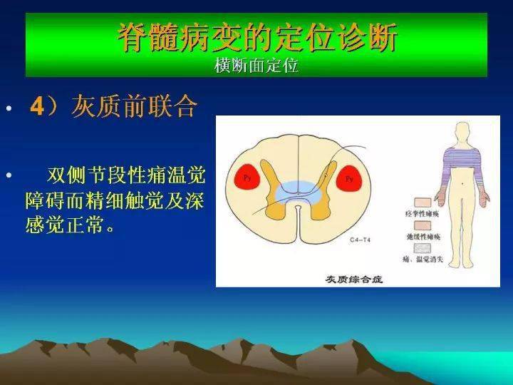 针刀临床总脊髓病变的定位诊断