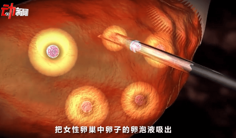 生殖技术管理办法》等指导文件,均对商业化供卵的相关行为明确说不