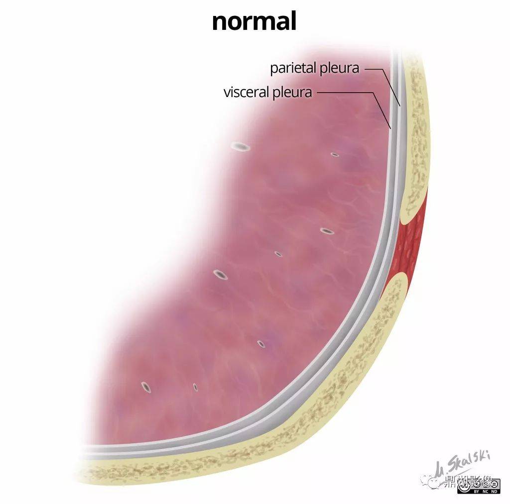 胸膜解剖详解