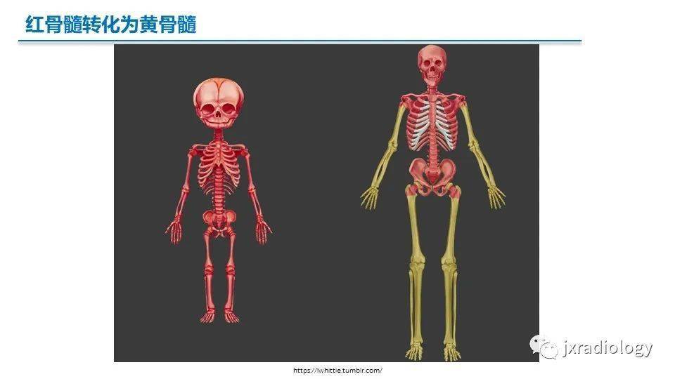 黄骨髓红骨髓图片