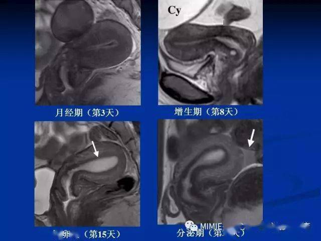 女性生殖系統正常解剖及表現