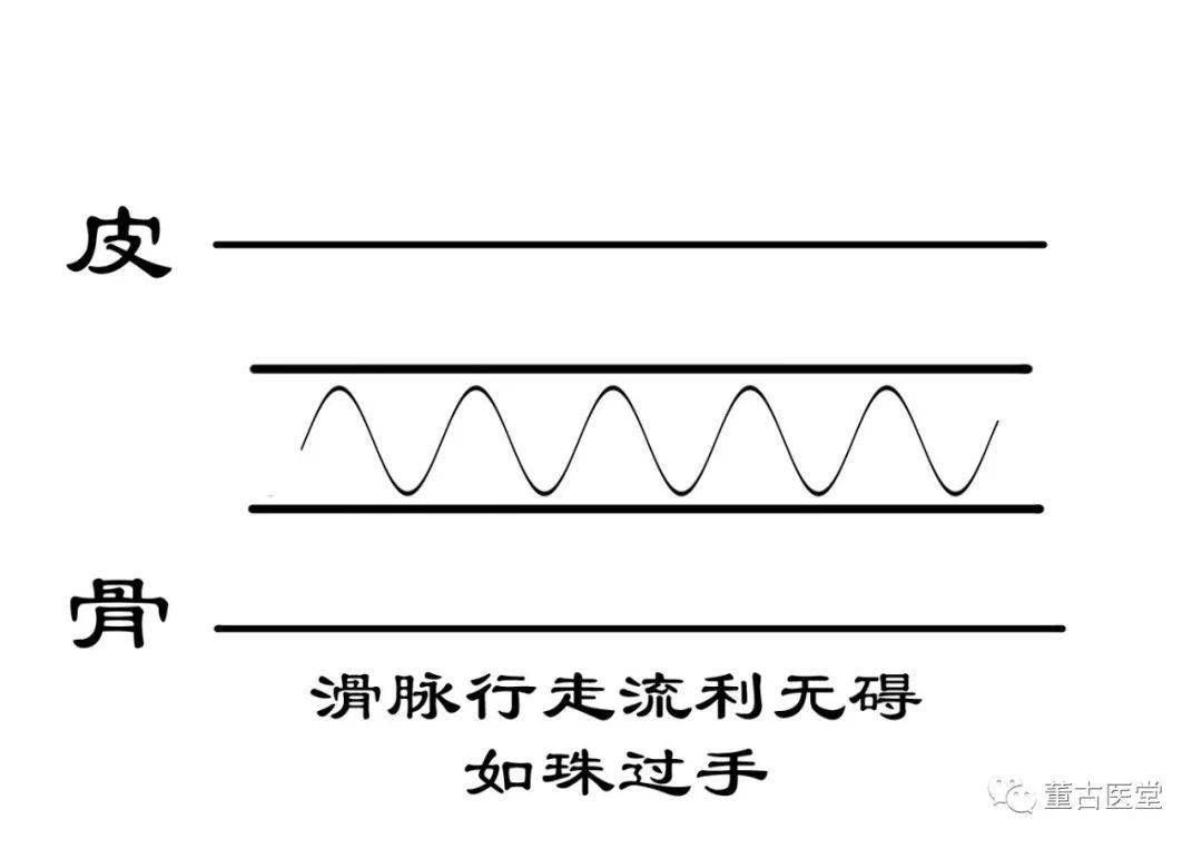 《图解脉诊》网络课问题答疑二 如何感受滑脉