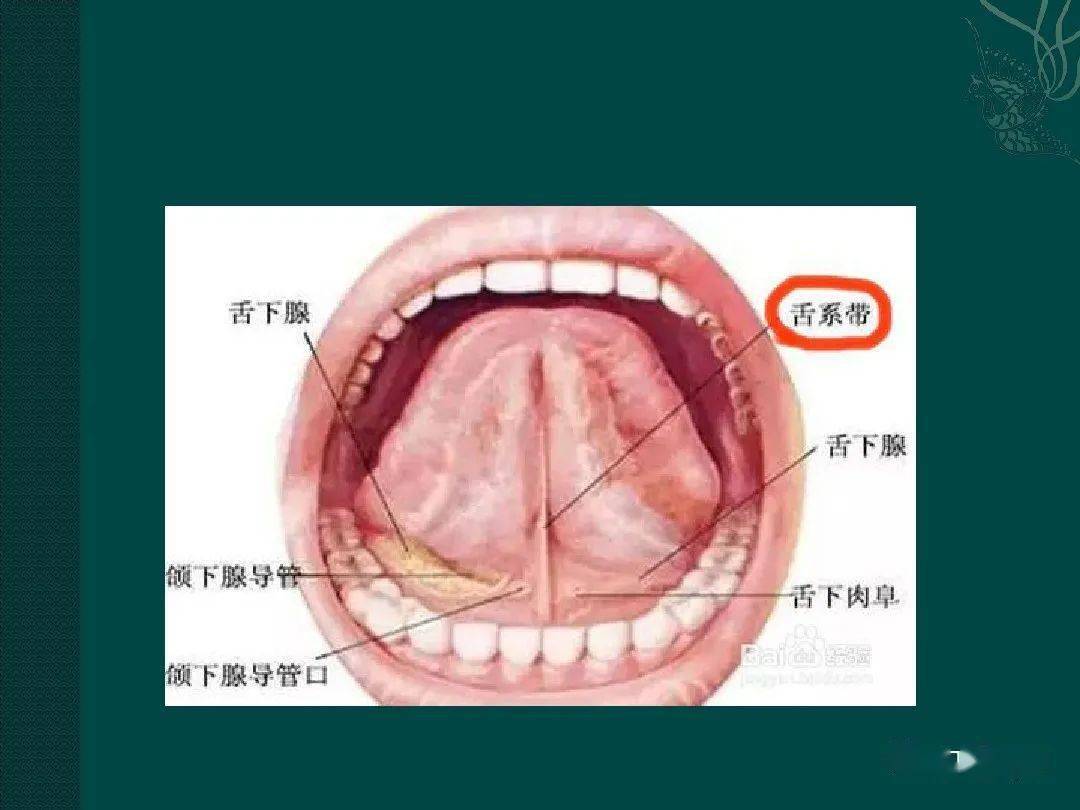 舌系带在哪个位置图片图片