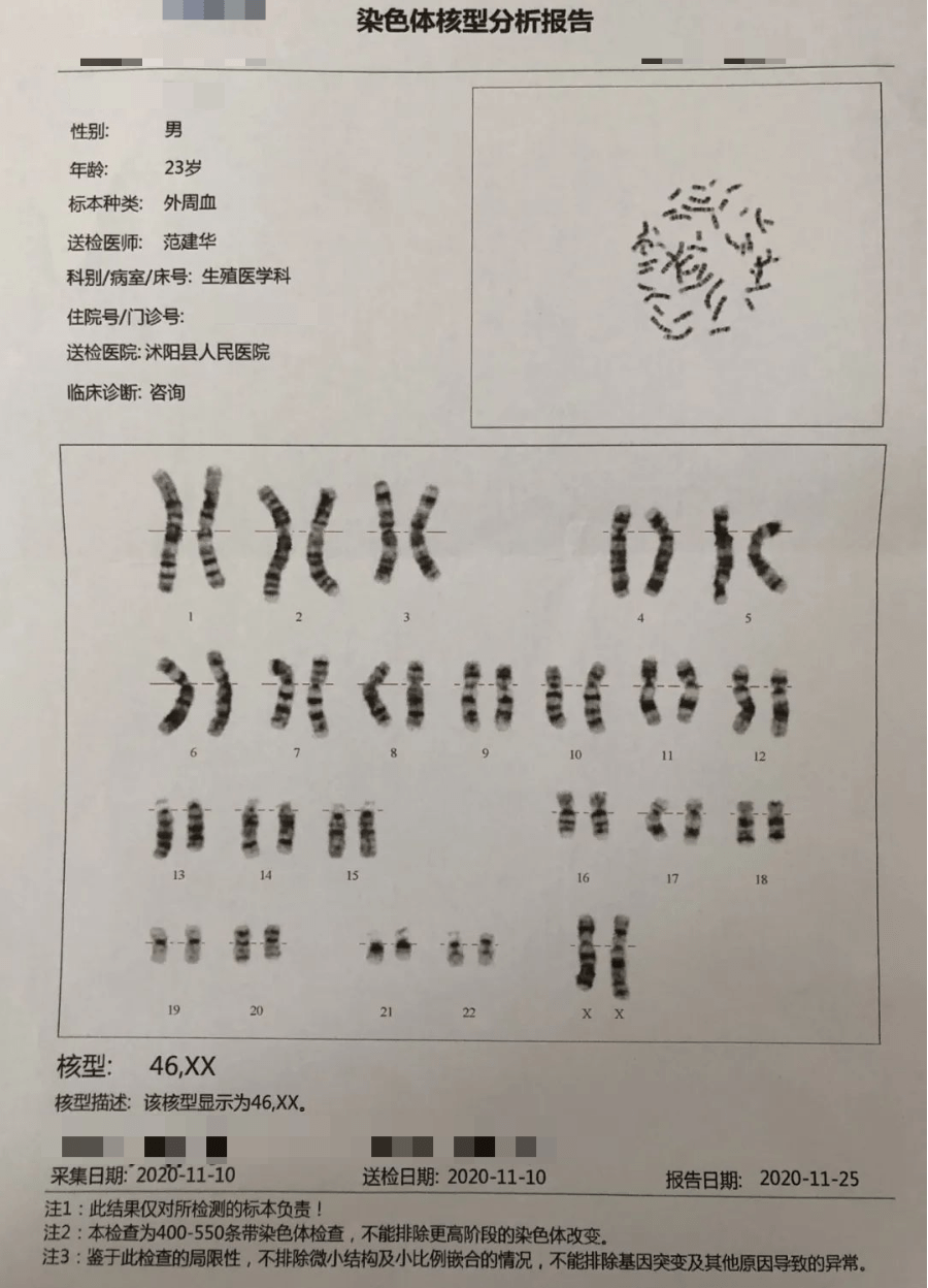 76 染色体核型 46