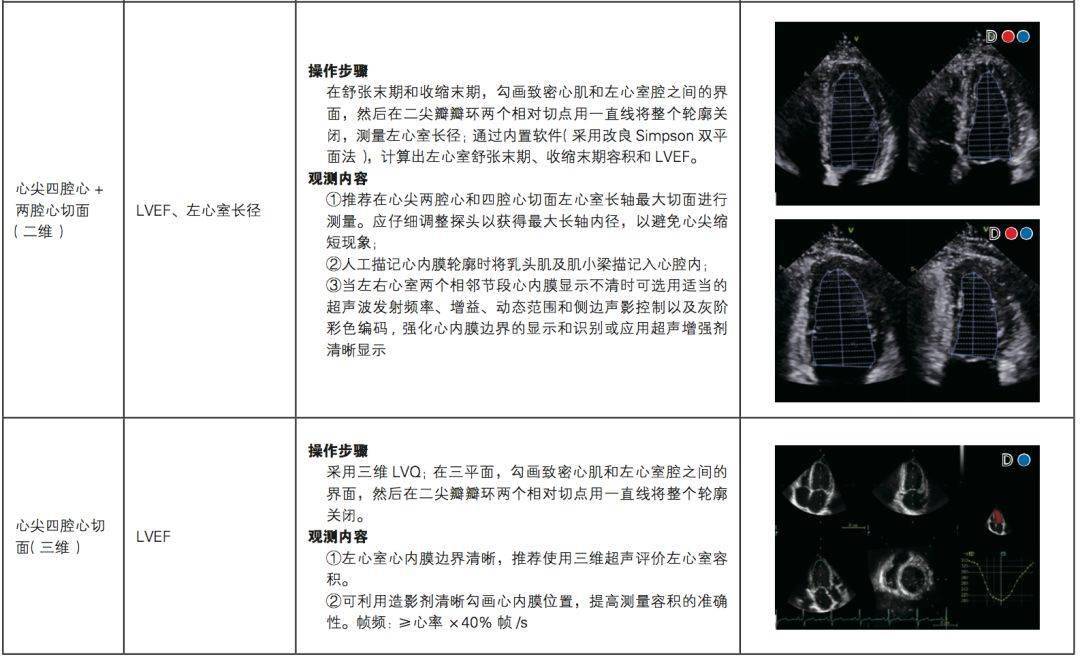 中国成人心力衰竭超声心动图规范化检查专家共识