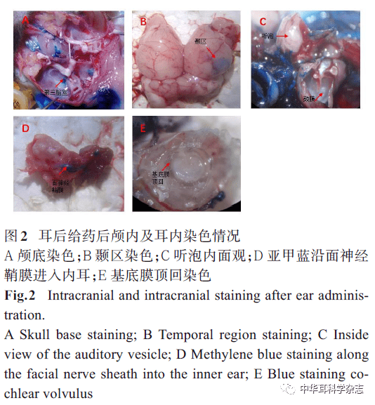 局部给药途径对内耳耳蜗作用机制的研究