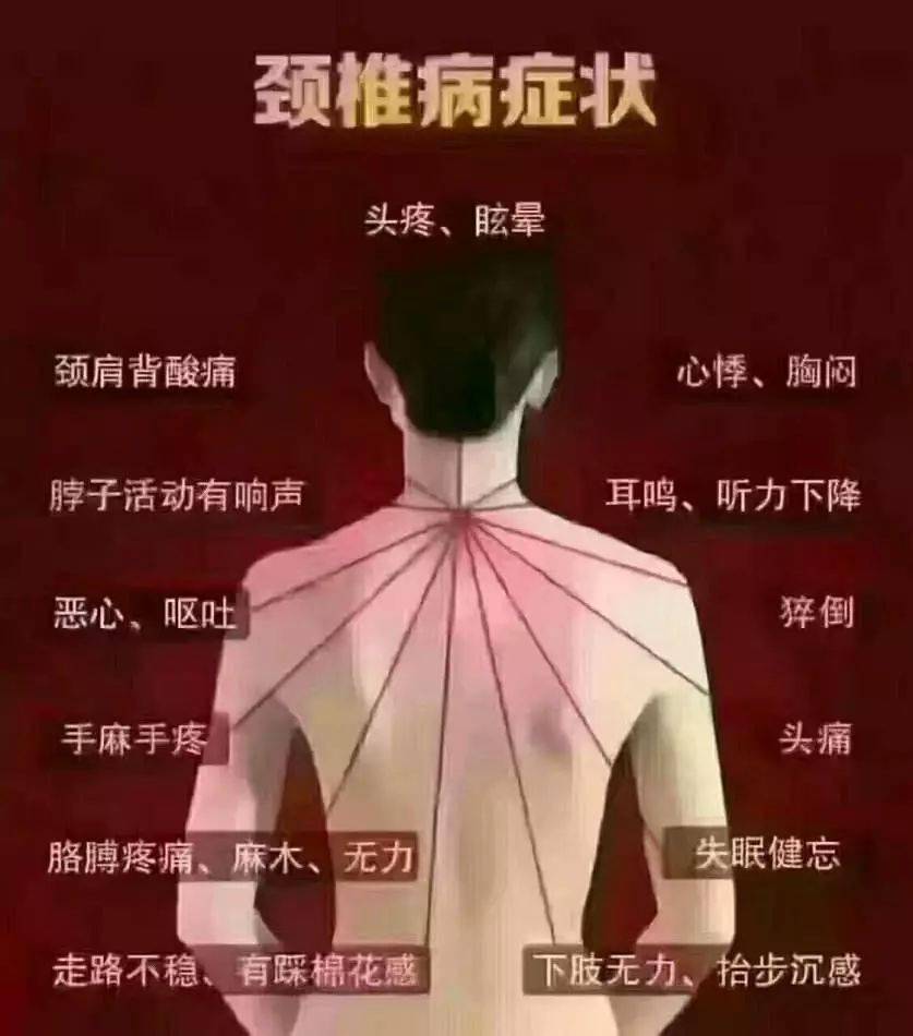 每日小知识:出现腰酸背痛,脖子痛的人,可别不当回事喽_堵则