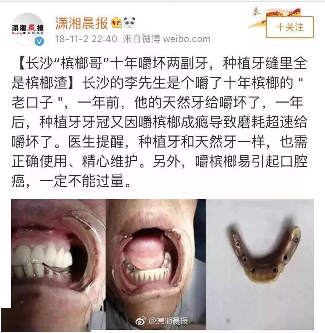 所以,吃槟榔的人,只要稍微有点年头,这个症状并不少见,这也是很多嚼